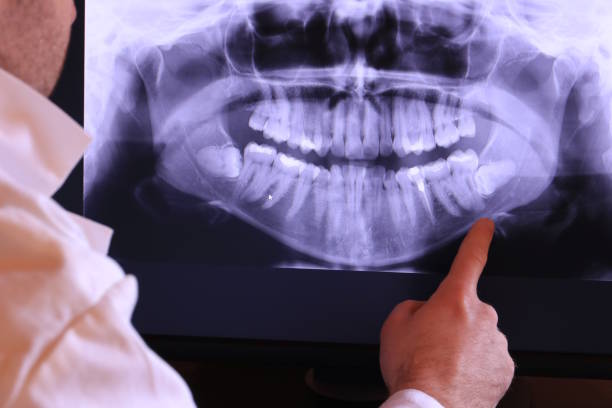 Best Emergency Dental Care for Broken or Chipped Teeth in Sterling, GA